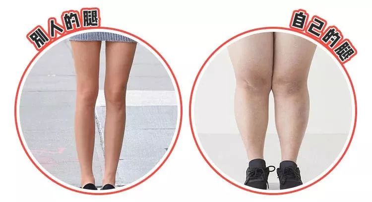 吴昕怎么改善o型腿,吴昕是怎么减掉小粗腿