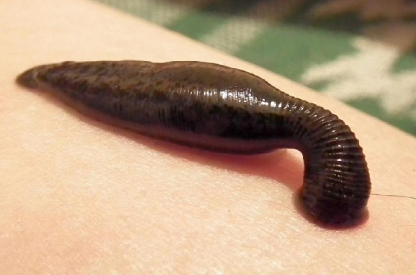 水蛭,从古到今它都是医生的帮手......