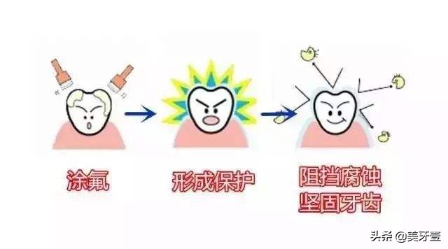 早期蛀牙怎么处理,早期的蛀牙怎么恢复