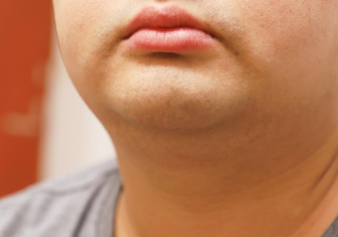 飞科剃须刀电动fs903测评,飞科fs903剃须刀拆解视频