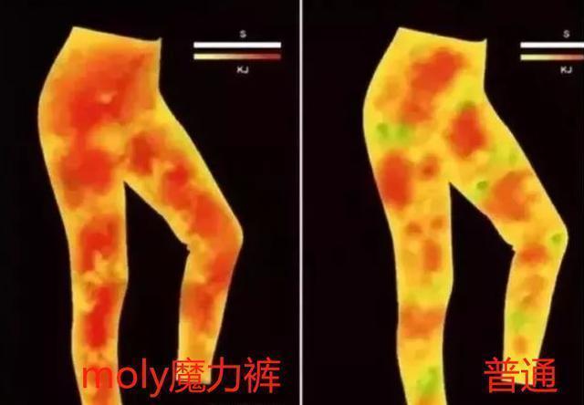 吴昕怎么改善o型腿,吴昕是怎么减掉小粗腿