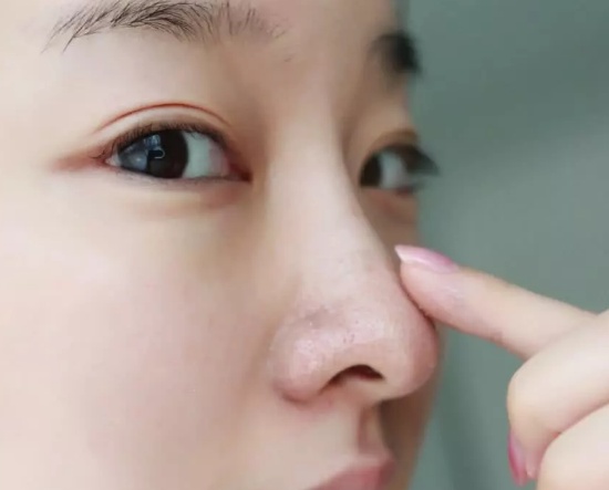 鼻子上总有小颗粒怎么解决,鼻子上都是小米粒怎么办