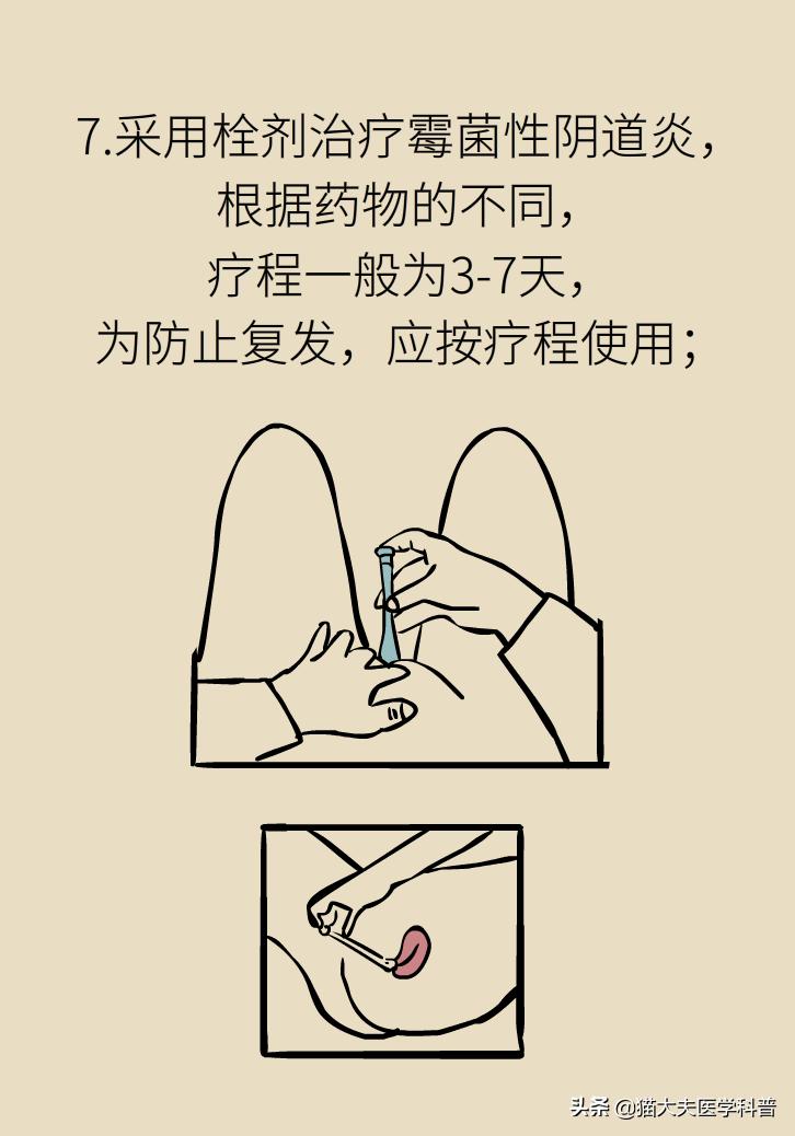 霉菌性阴道炎真的是里面“发霉”了吗？药师教你“抗霉”*法大**