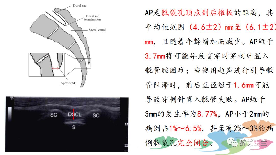 局麻药中毒的术前用药口诀,局麻药中毒临床表现及处理流程ppt