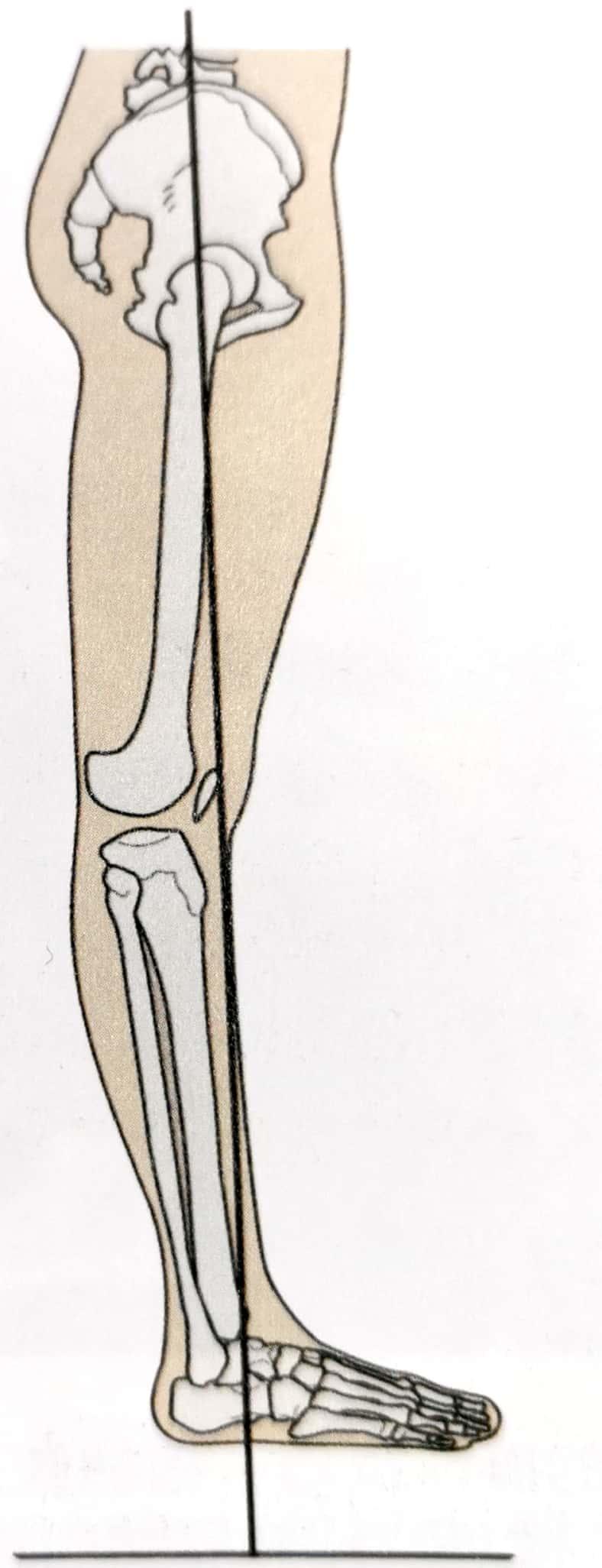 裤子历险记——腿太弯怎么办？