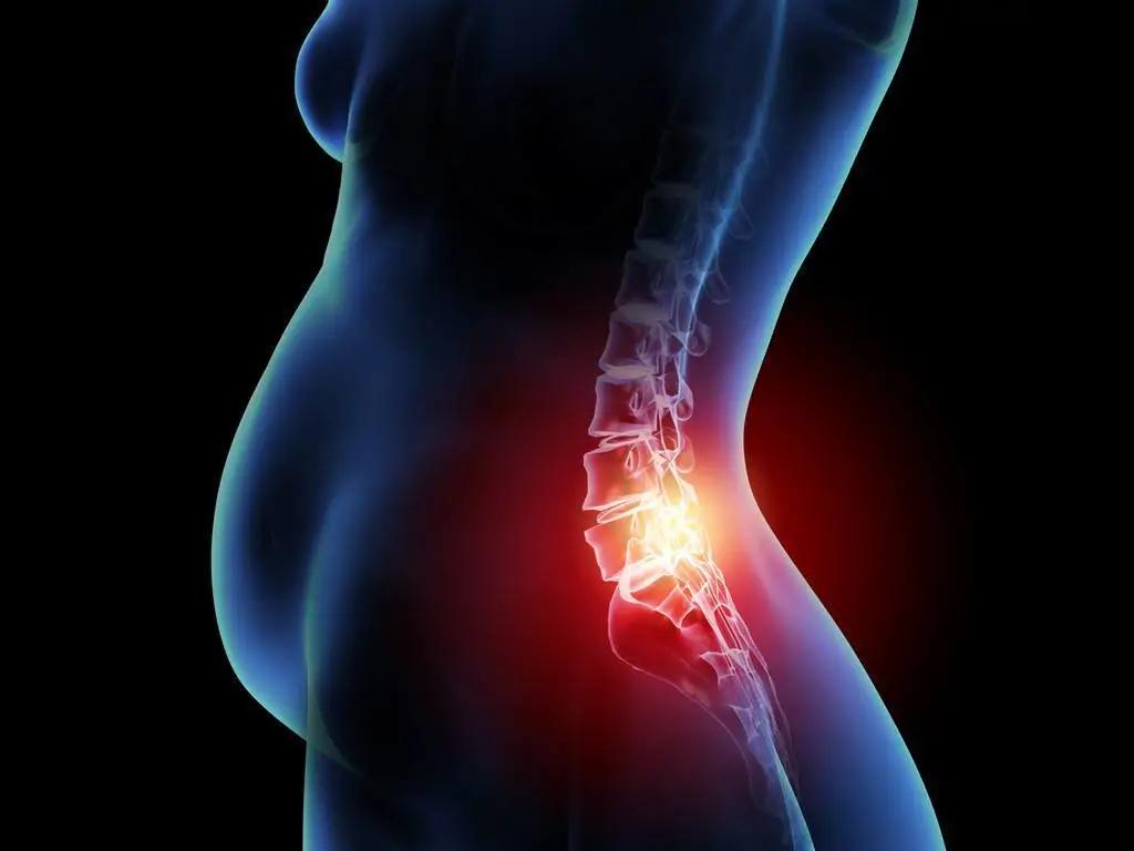 二胎产后腰疼背疼,应采儿二胎后腰疼