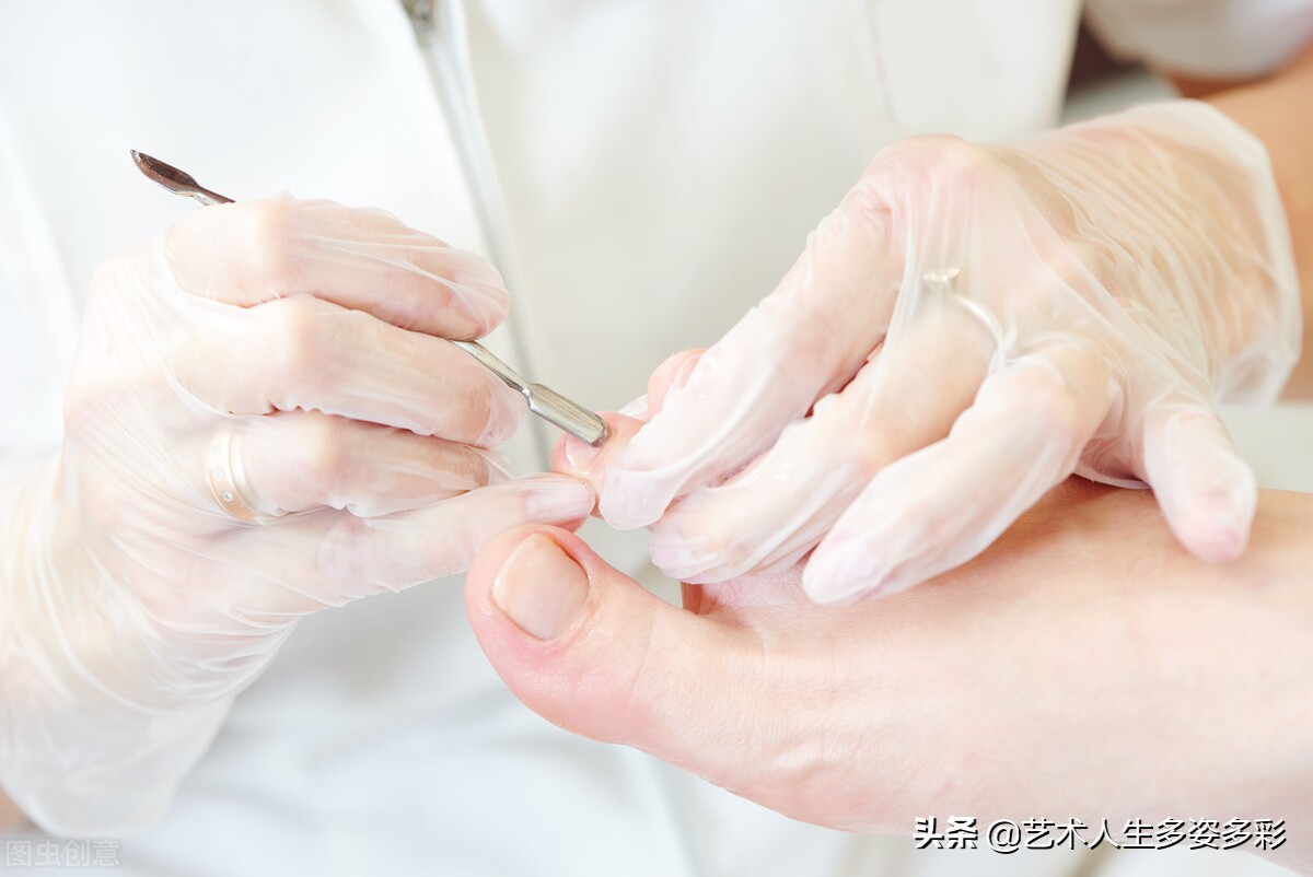 第一次修脚的视频,第一次修脚