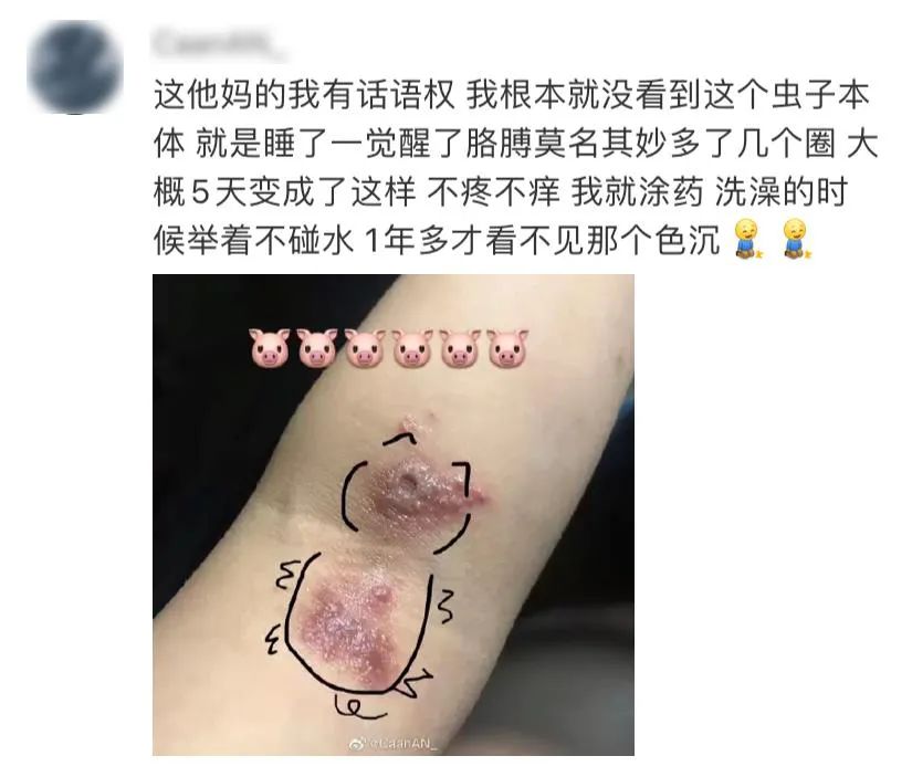 晚上玩手机会毁容的虫子,前一晚关灯玩手机被虫毁容