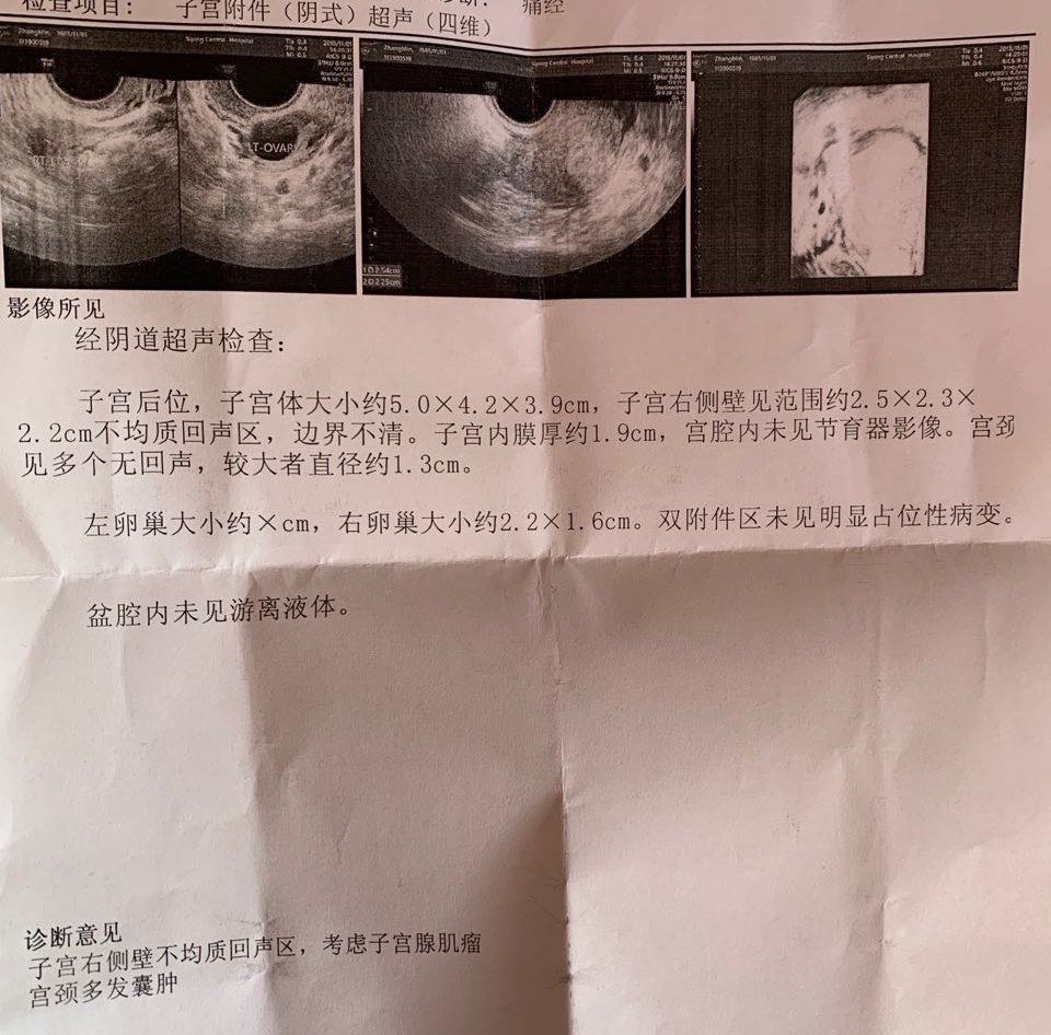 湿热瘀阻致经期延长痛经,痛经时间越来越长怎么回事