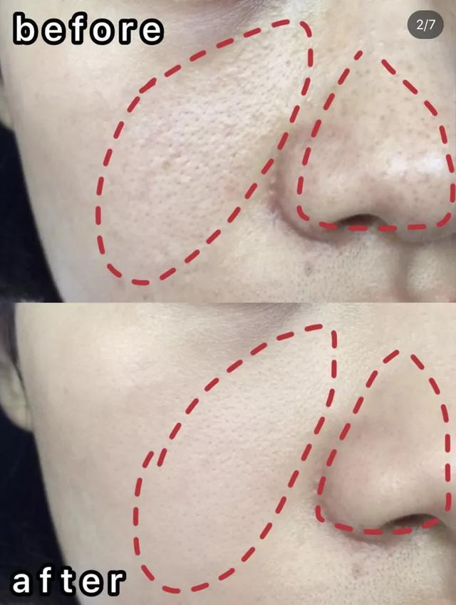 张韶涵护肤全部产品,张韶涵海蓝之谜