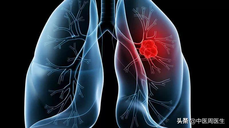 你知道吗这三种习惯最伤肺,伤肺的4件事