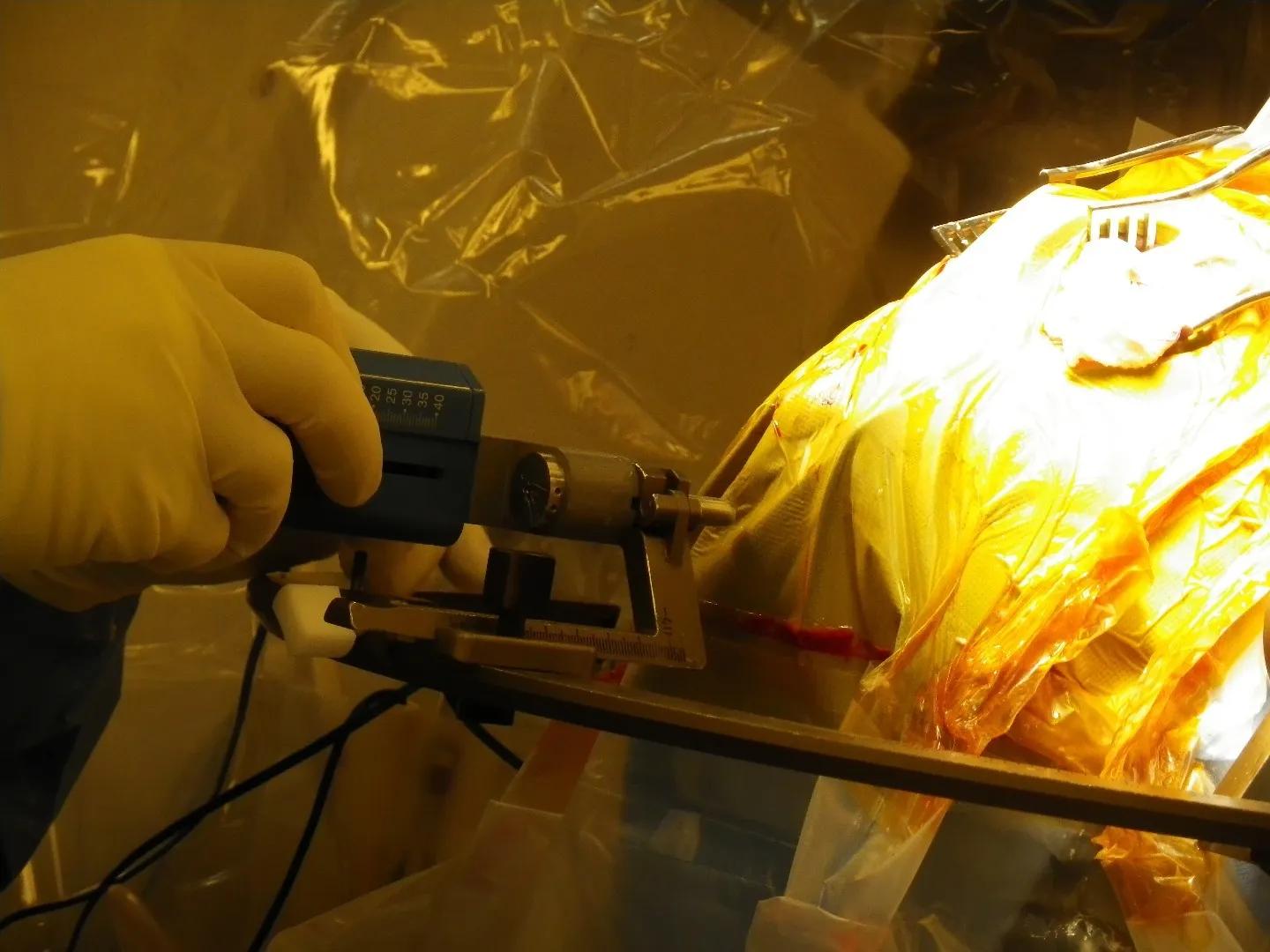 帕金森病应药物联合手术治疗愈后疗效更佳