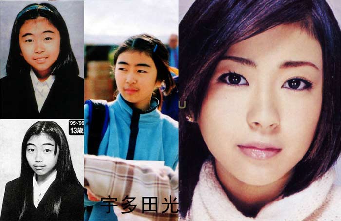 日本整容惊人案例,日本整容是不是最先进