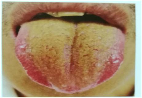 中医经典舌诊和中医全息舌诊区别,中医舌诊知识大全图片