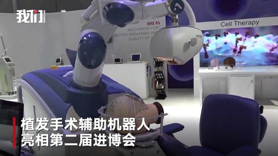 阿里扎心年终奖：价值“三万八”的植发钱公司掏，这波不亏