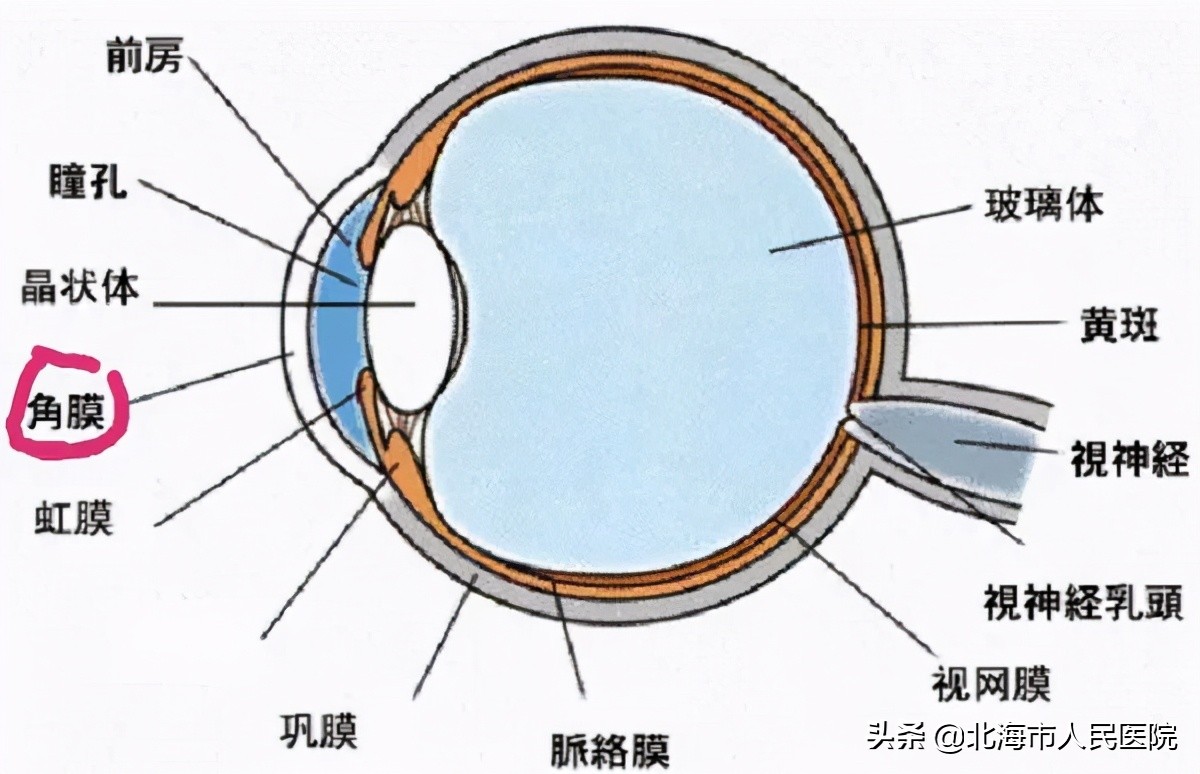 飞虫进眼用手揉致角膜感染溃烂,飞虫进眼睛出来后眼睛红血丝