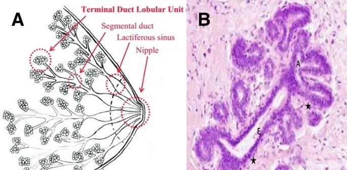 女性绝经后乳腺增生会痊愈吗,困扰多年的乳腺增生