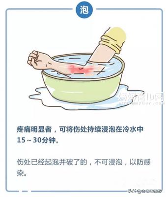 又有婴儿被烫伤，急救方法你会吗？