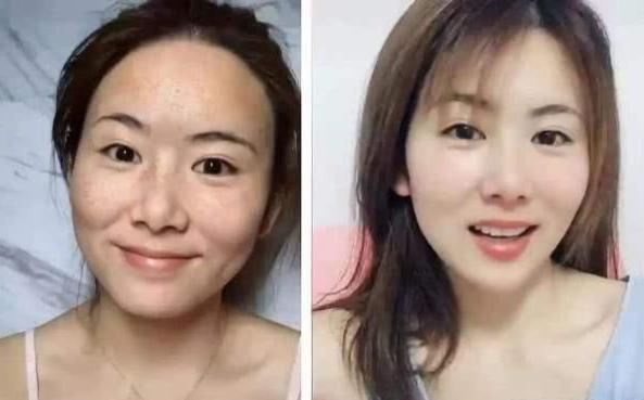 小苏打加牛奶敷脸能去皱纹吗,小苏打搭配什么敷脸最好