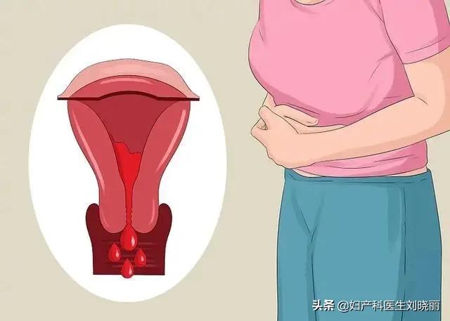 你的大姨妈,大姨妈颜色分别代表什么