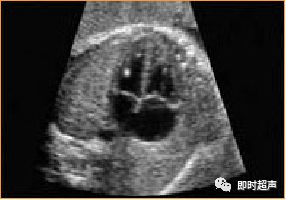 产科常规彩色超声报告单介绍,常见妇科疾病超声报告