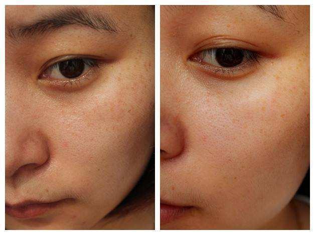 张韶涵护肤全部产品,张韶涵海蓝之谜