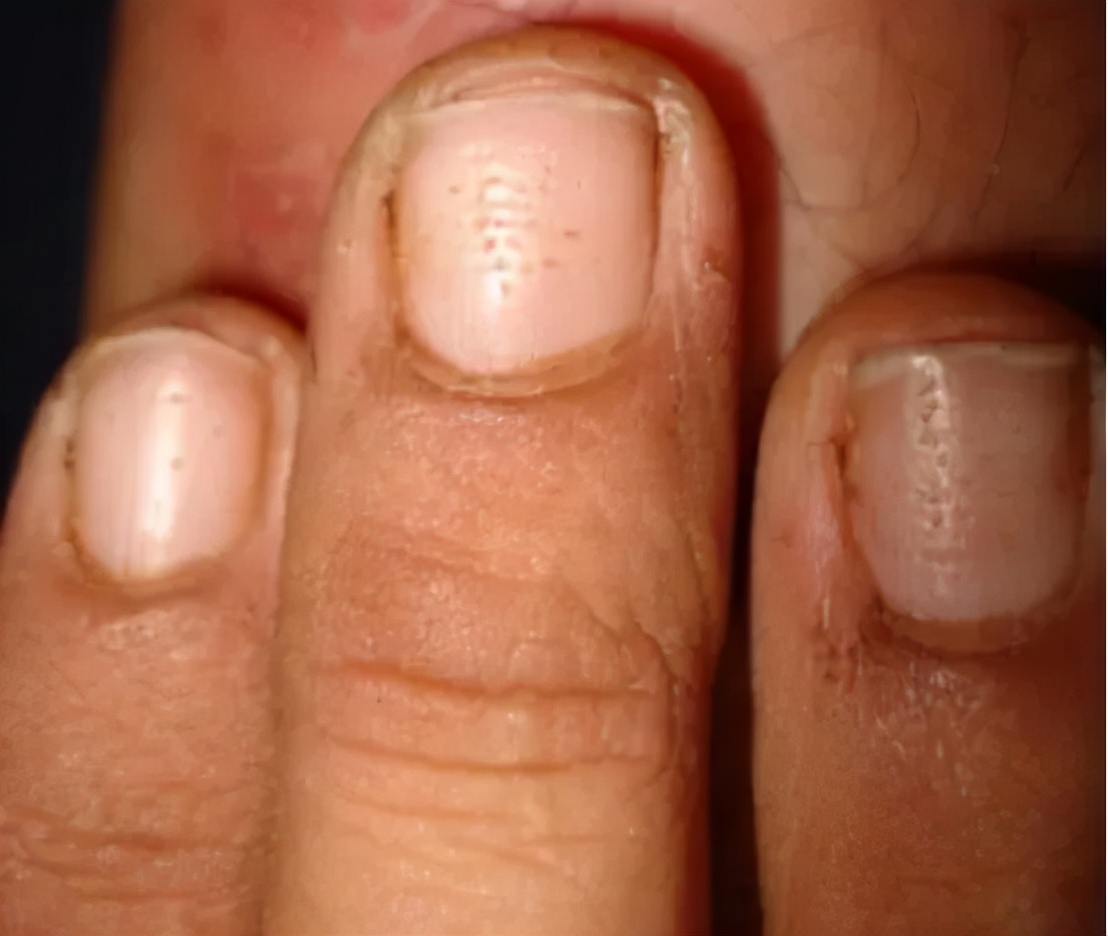 如何不做美甲就能让指甲变得精致,美甲教学指甲的简单基础护理