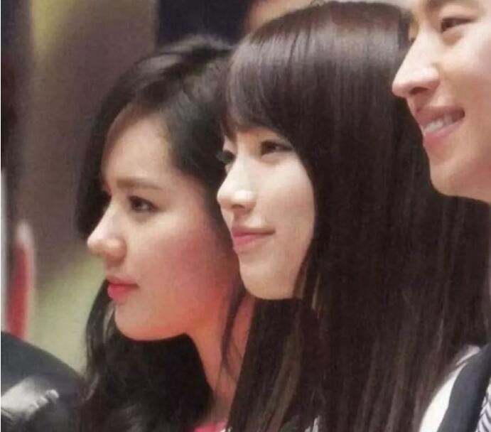 面部一枝花全靠鼻当家，论鼻子对颜值的重要性▼