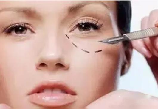 祛眼袋冷知识,祛除眼袋哪种方式既安全又有效