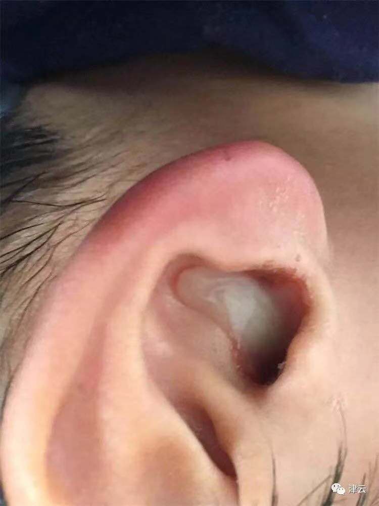 开水烫*体下**灌消毒液残忍的女人对待继子你怎能下得去手?