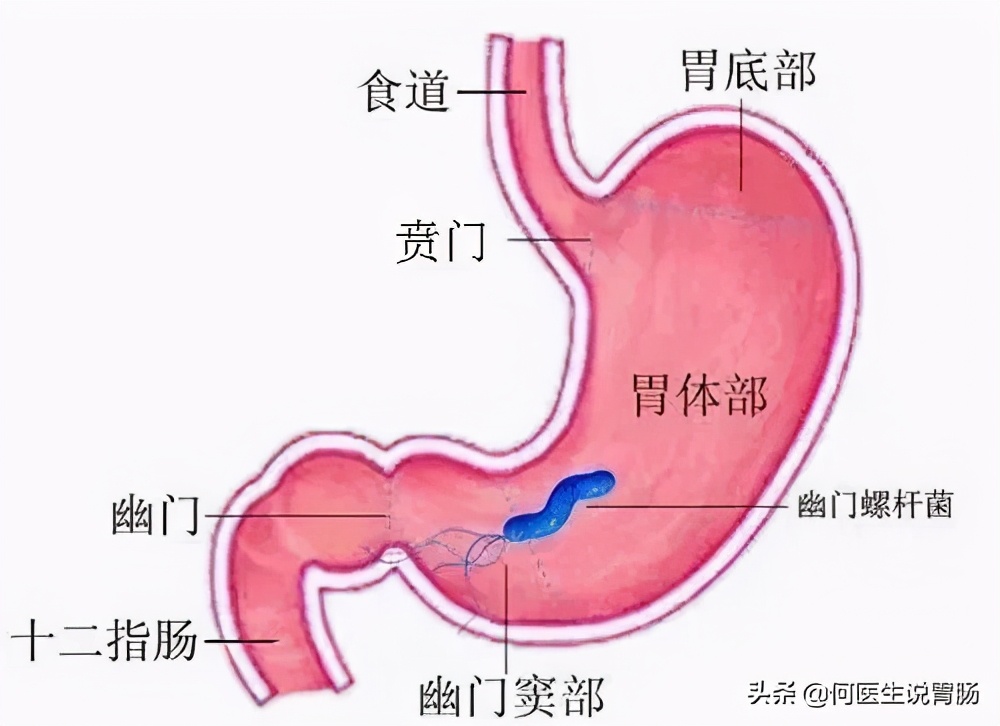 全国超过一半人感染幽门螺杆菌,全国有多少个人感染幽门螺杆菌