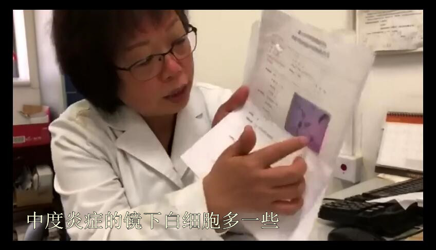 tct结果报告示中度炎症,tct提示中度炎症需要治疗么