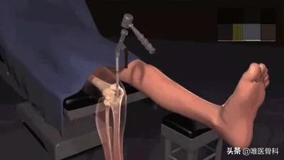 怎样练成逆天大长腿,怎样从小短腿练成大长腿