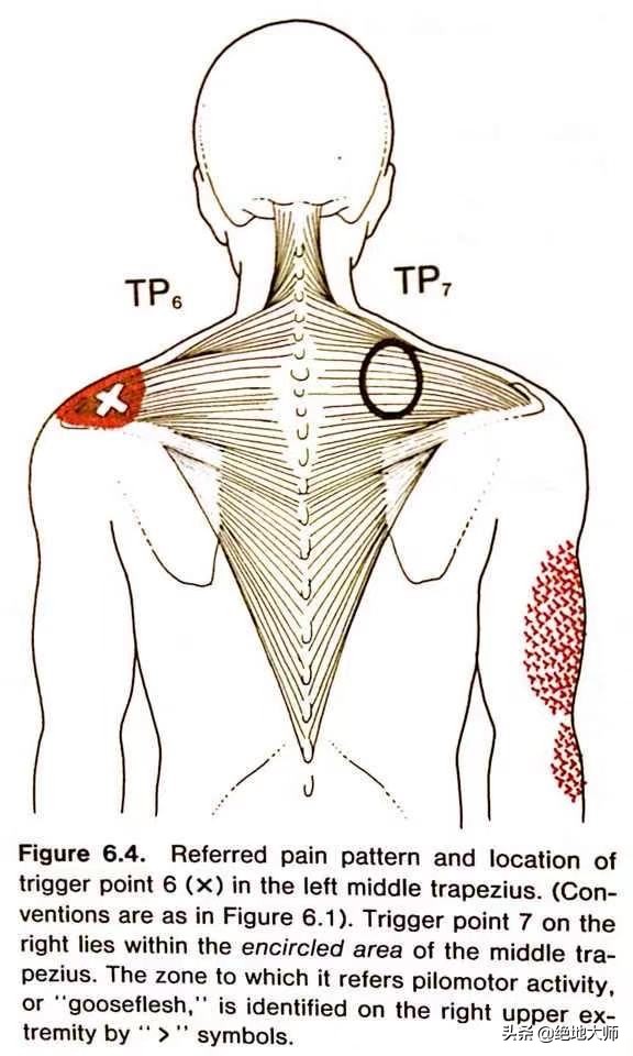 肩胛疼痛为何要做康复,肩胛区疼痛治疗