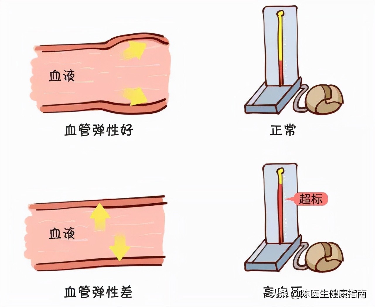 老年人脉压大怎么处理,老年人脉压差大是什么原因