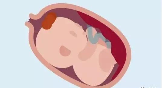 子宫壁薄不易怀孕,子宫壁太薄怀不上孩子原理