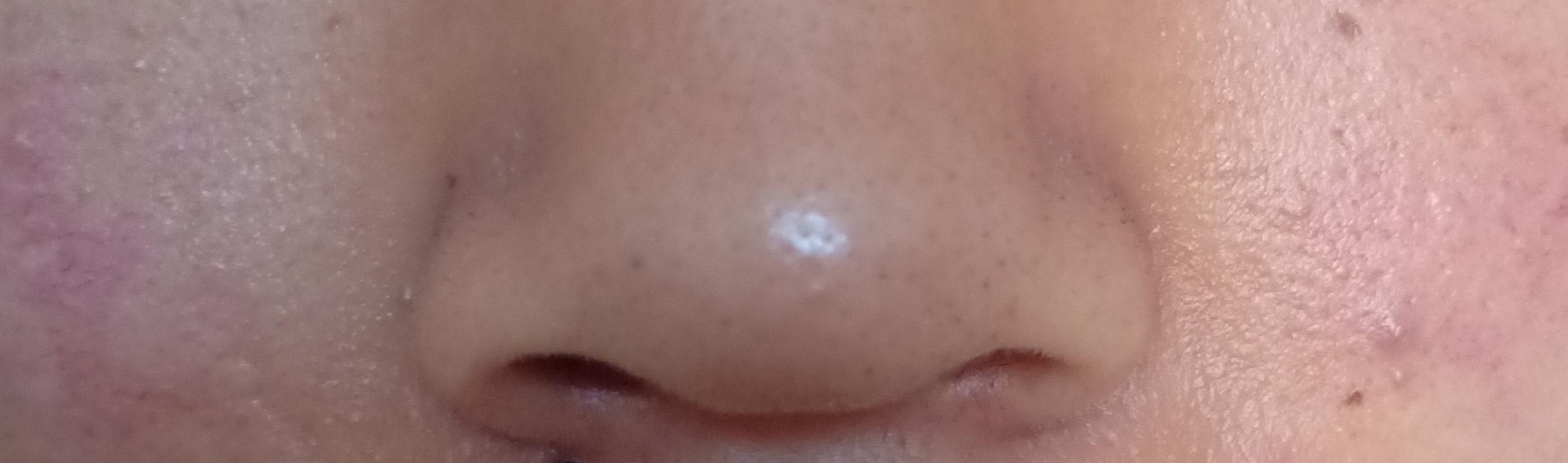 关于黑头的问题和解决方法,去黑头的误区许多人都中招了