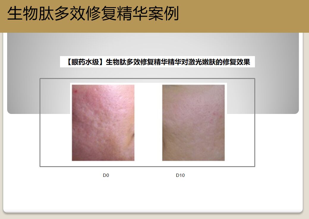 多肽水润蚕丝修护面膜,童颜美肌补水面膜