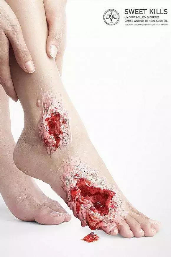 吃太多的糖会让你变胖,让你变丑变老的不是脂肪而是糖