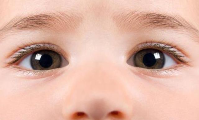 刚满月宝宝眼睛有一只不一样大,刚满月的宝宝眼睛一直红