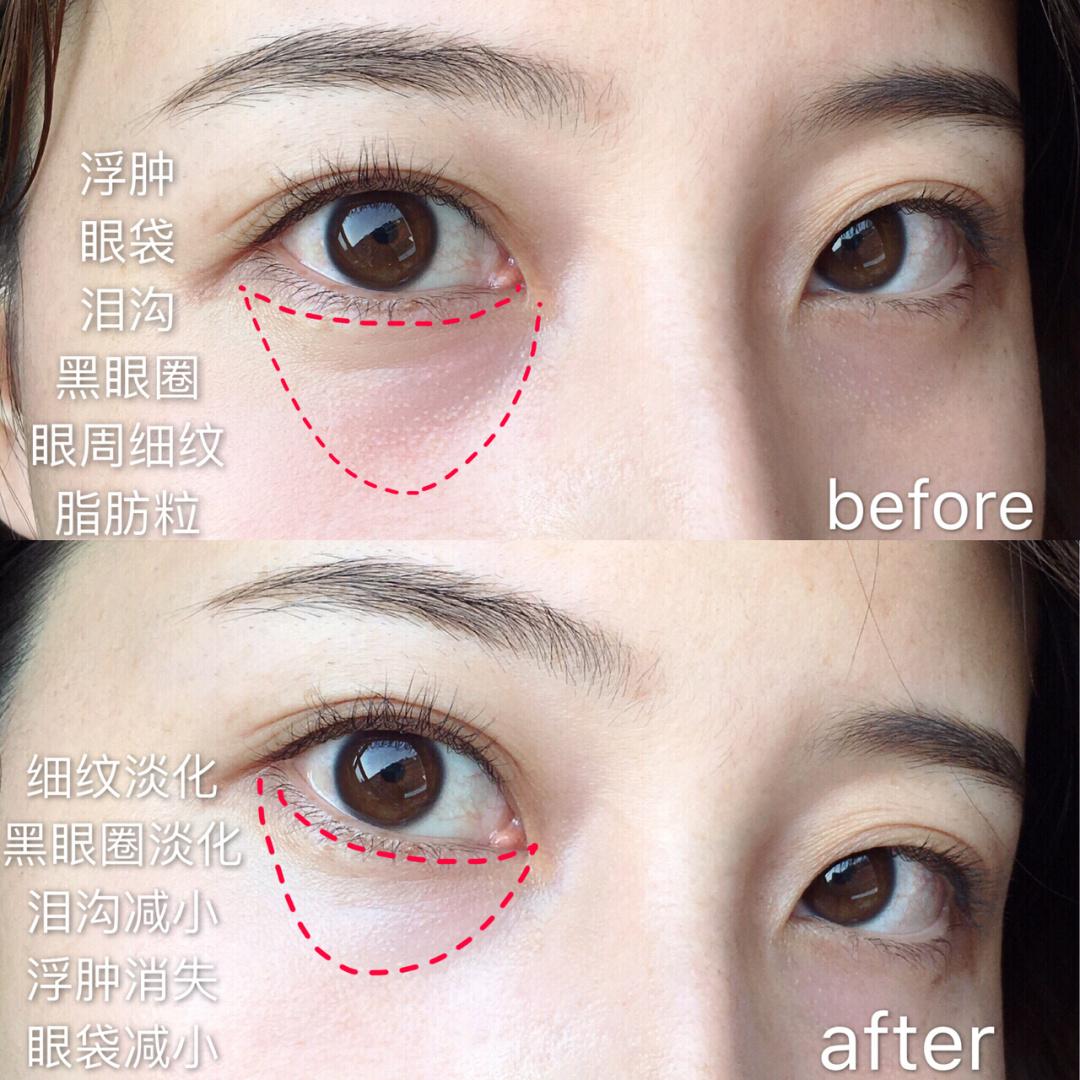 十大良心国货眼霜排名,被遗忘的好眼霜