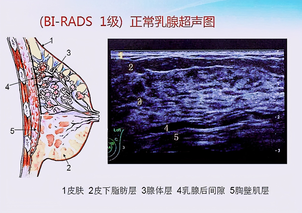 乳腺肿块活检穿刺多少钱,乳腺穿刺活检为肿瘤病变