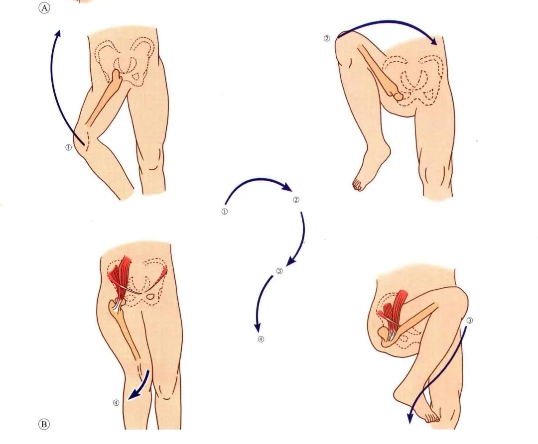 犬髋关节脱位闭合复位,髋关节脱位的闭合复位