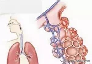 便秘引起肠道有积气,便秘肺大泡