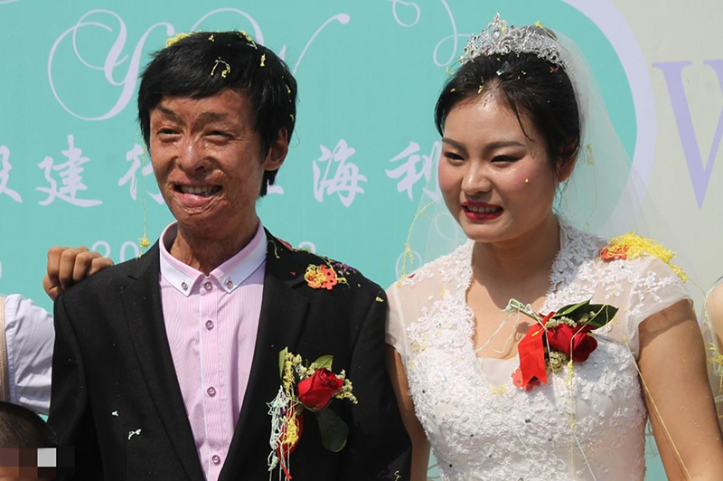 21岁小伙烧伤13人,21岁小伙一人救13人被烧毁容