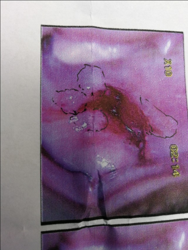 女人有妇科困扰吗,女人常见的妇科问题