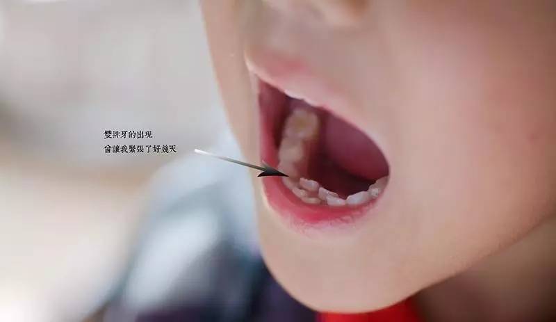 疫情期间口腔有溃疡怎么办,疫情期间怎么看口腔疾病
