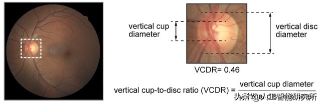 人工智能基因组学,人工智能基因预测