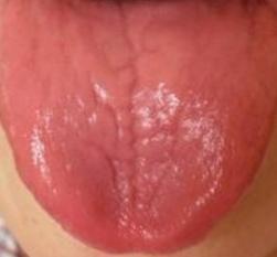 又上火了怎么回复,急火上火