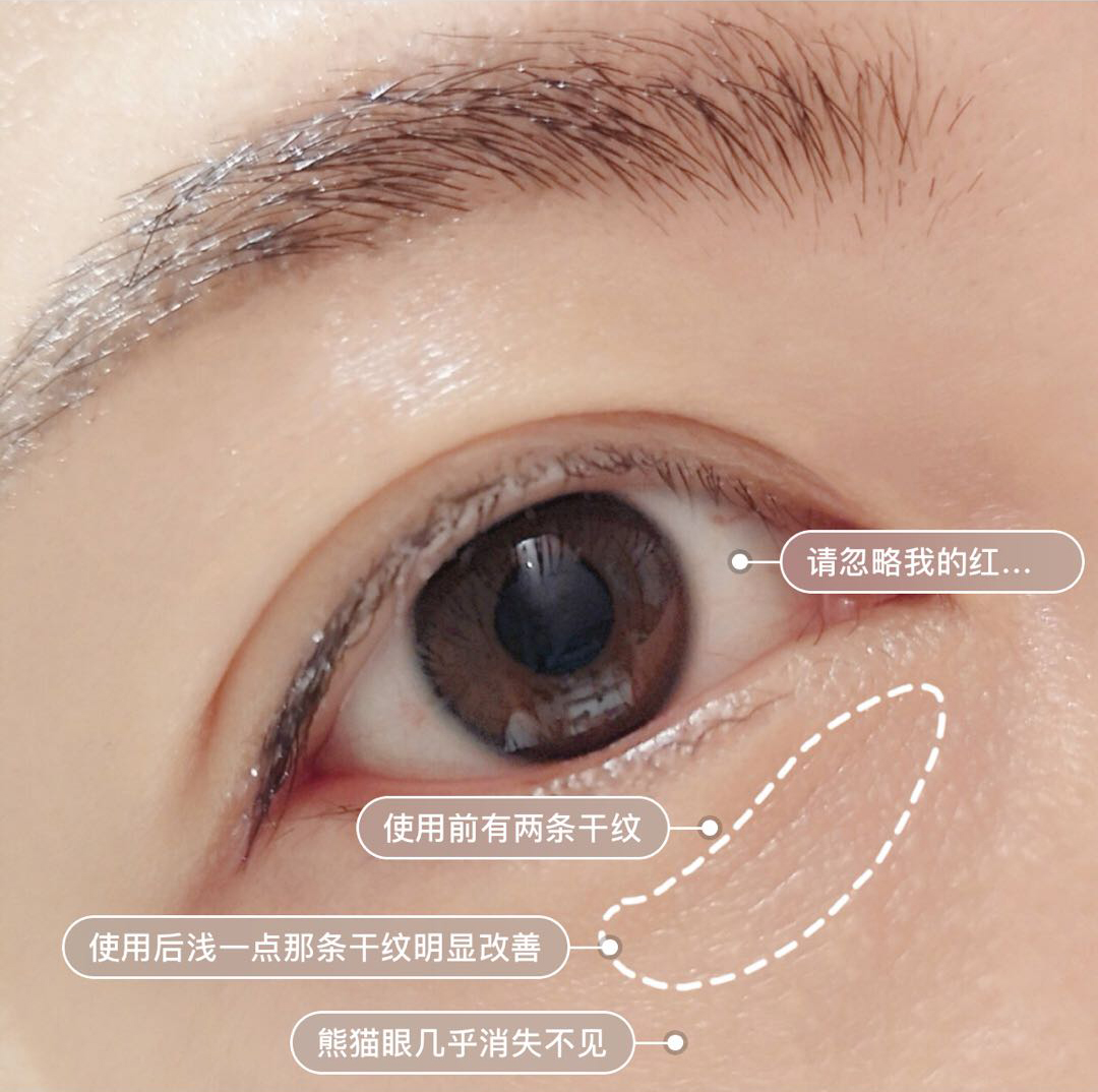 眼霜如何挑选先来看看这篇干货,眼霜排名十大公认好用的眼霜测评